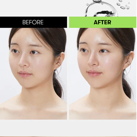 Тонер-пэды REEDLE SHOT SYNERGY SPARKLING TONER PAD